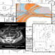 Composite image showing architectural plans, geology map, electronic circuits and MRI scan